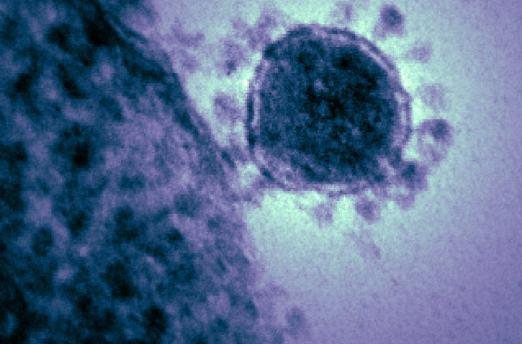 mers cov 475443