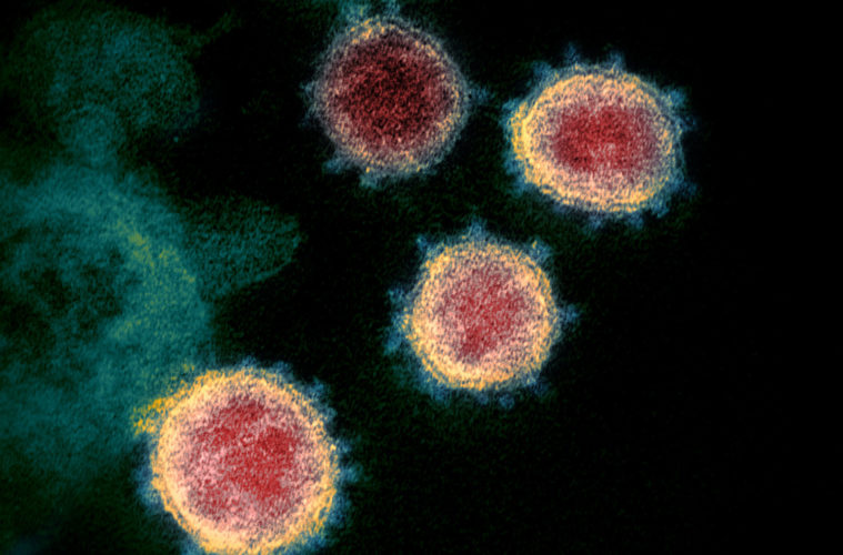 <i>Plandemic</i> Plethora: The Best Reportage About the Conspiracy Doc to Help You Make up Your Own Damn Mind 38 novel coronavirus sars cov 2 884045