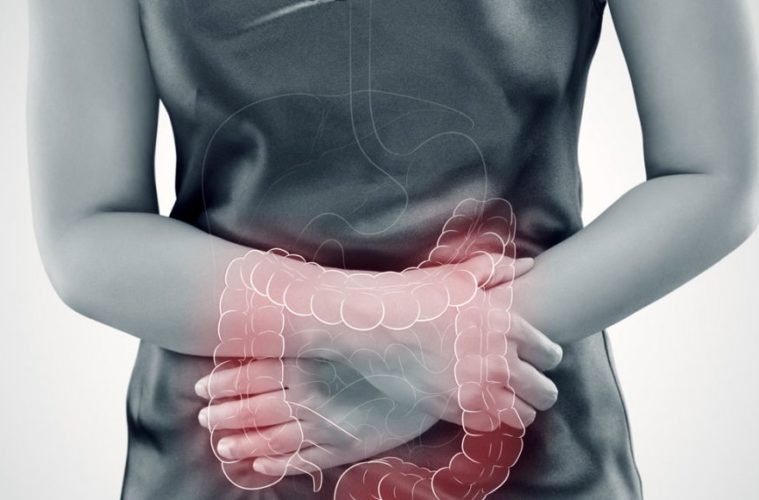 Yes, Cannabis Fights Chronic Gut Problems — Here’s How 38 rx irritable bowel syndrome and cannabis 1068x580 1