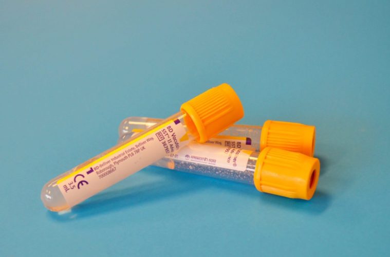 These People Are First In Line To Get COVID-19 Vaccine 38 here are the groups thatll get the covid vaccine first according to the cdc e1606760561692