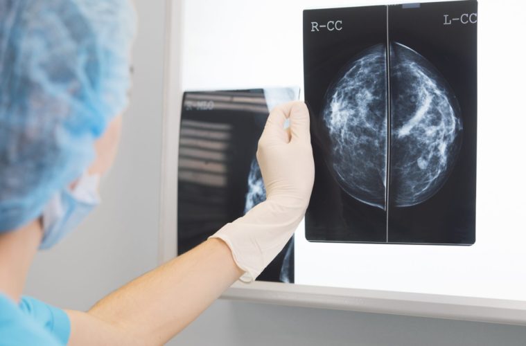 The COVID-19 Vaccine Might Be Messing With Your Mammogram 38 Mammogram 1