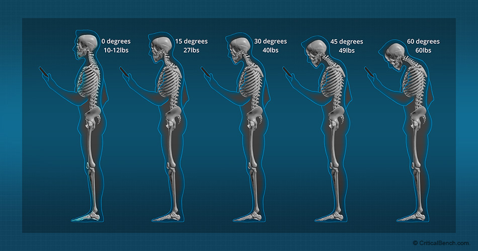 Forward Head Posture Fix Reviews – (I've Tested) My Honest Experience! 38 Forward Head Posture Fix complaints