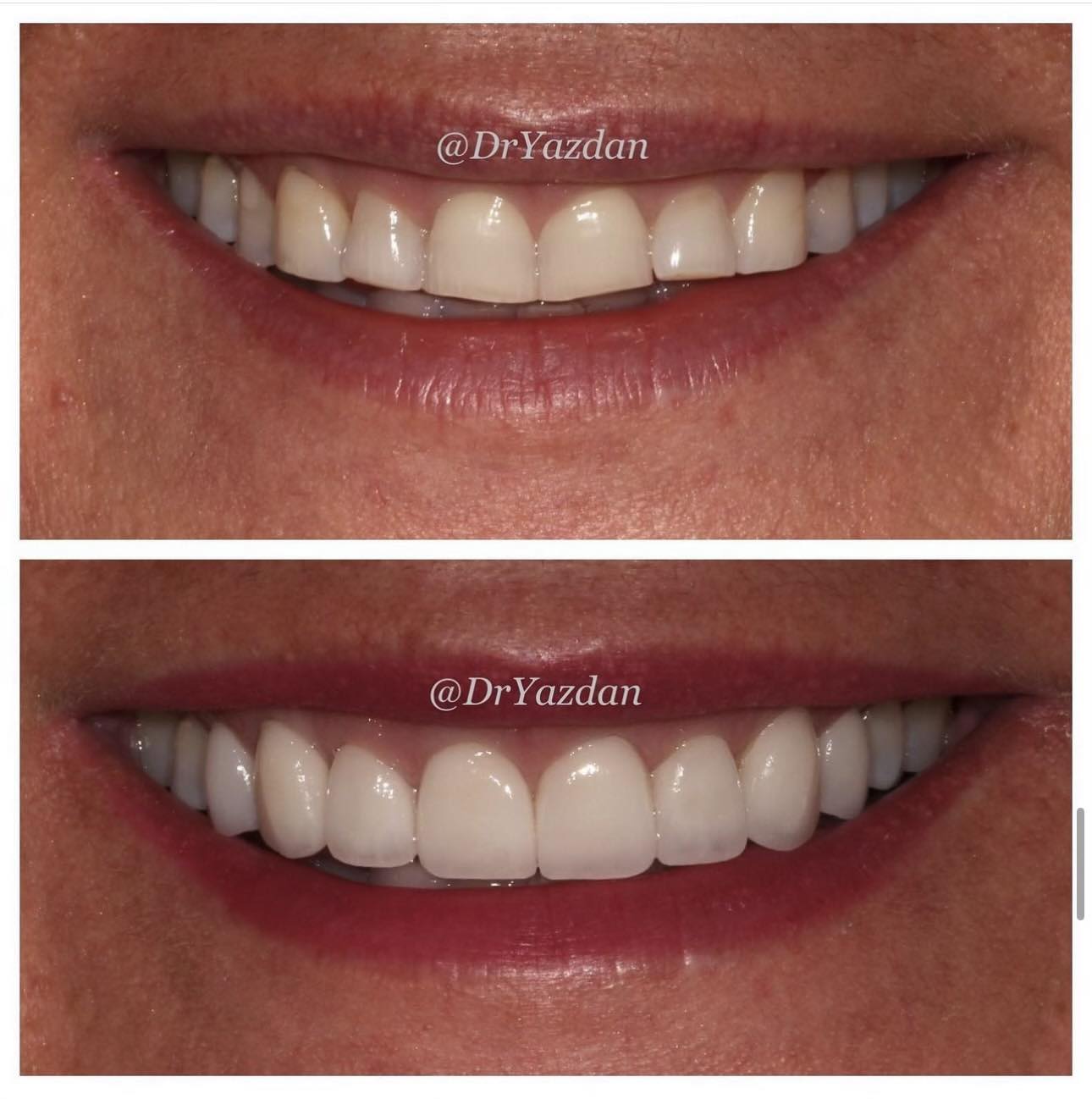 Transforming Smiles, Transforming Lives: The Power of Cosmetic Dentistry 38 image1 6 073024