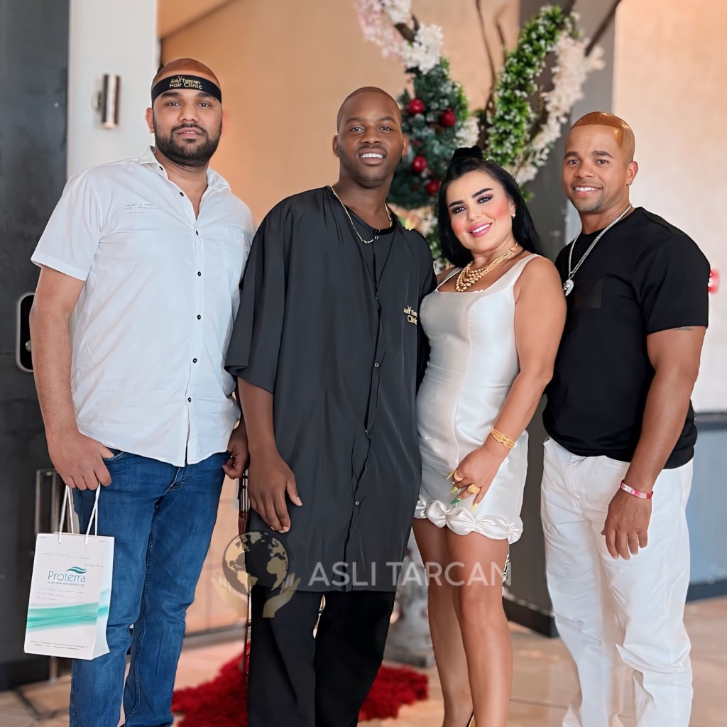 Afro Hair transplant with Asli Tarcan Turkey