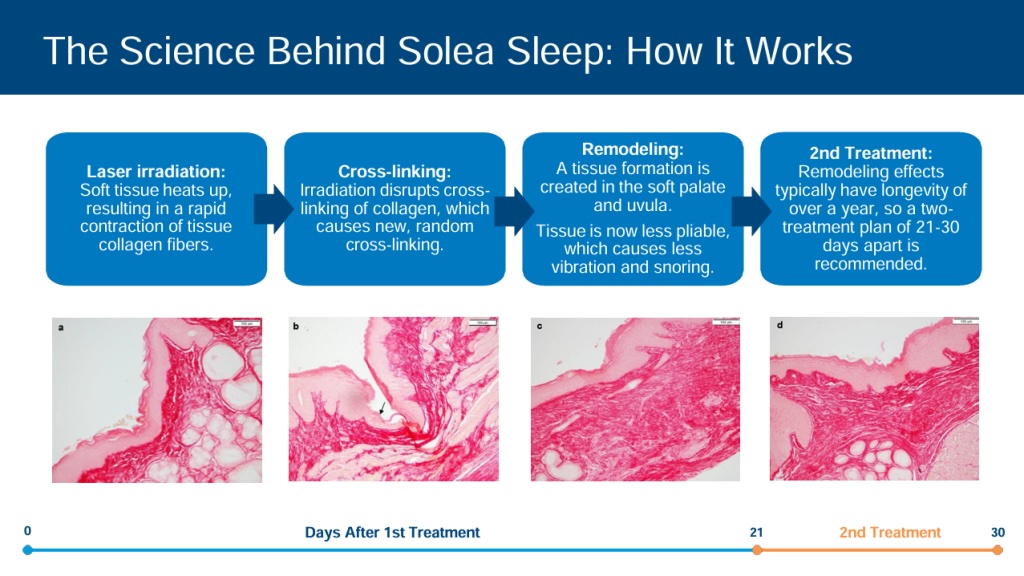 solea collagen effect
